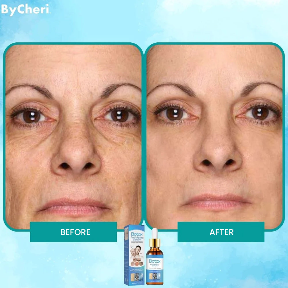 Botox Anti-Aging Serum (1+1 FREE)