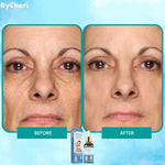 Botox Anti-Aging Serum (1+1 FREE)